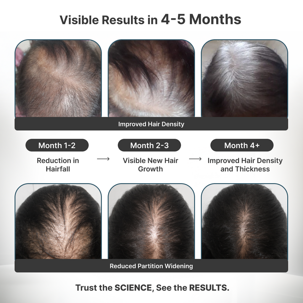 Female Foundation: Advanced Hair Growth Kit