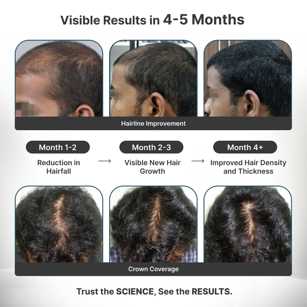 Reset: Clinical Max Hair Growth Kit