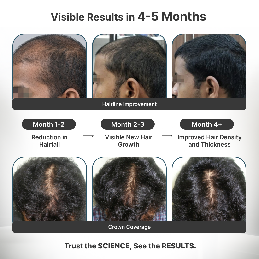 Reset: Clinical Max Hair Growth Kit