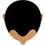 Stage 1 (Hair thinning)
