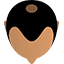 Stage 3 (Balding crown)